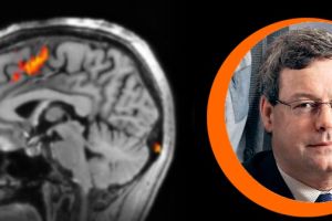Workshop MRI – Curso Hands-on com o Prof. Richard Frayne