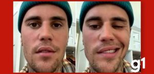 CEPID BRAINN - Justin Bieber e Fernando Cendes - Portal G1