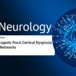 CEPID BRAINN - Blog - Pesquisa MELD Graph Epilepsia na JAMA Neurology