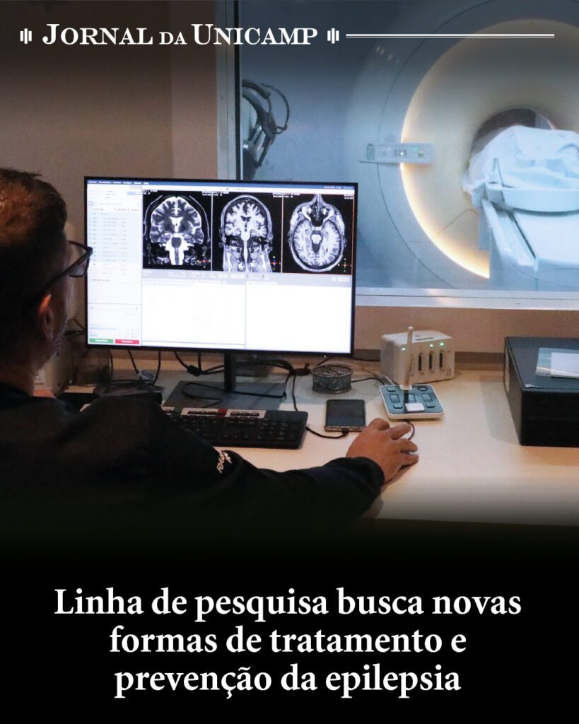 CEPID BRAINN - Jornal da Unicamp - Materia Epilepsia com Fernando Cendes e Iscia Lopes-Cendes - Instagram 1
